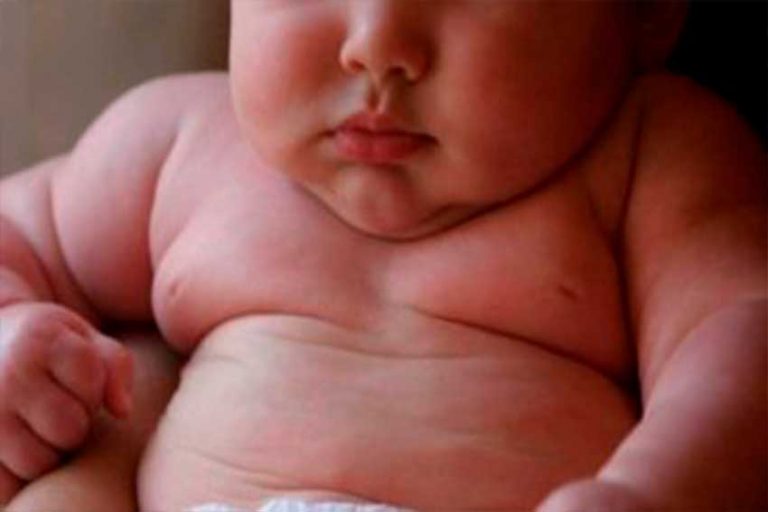 Niños con obesidad tienen mayor riesgo de muerte prematura