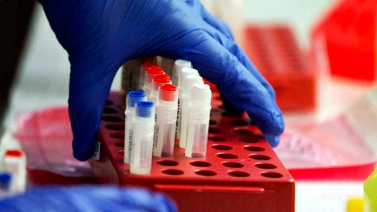 Un fallecimiento y 115 bioanalistas infectadas de COVID-19 en el país