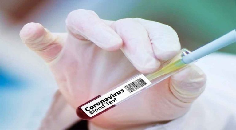 Salud Pública reporta otras 28 defunciones y 428 nuevos casos de Covid-19