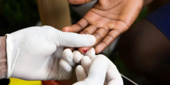 En el país hay más de 72 mil personas con VIH solo el 82% conoce su estatus