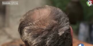 Mercado negro de pelo