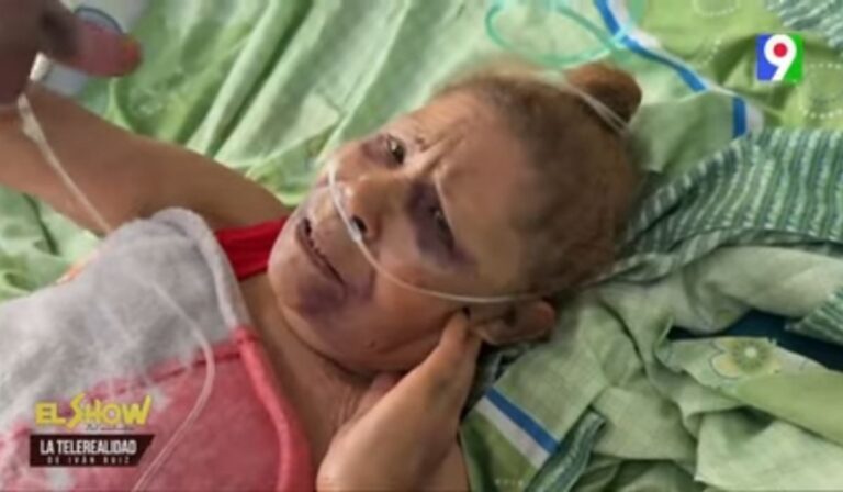 Anciana de 86 años fue golpeada por haitianos y su vivienda fue quemada