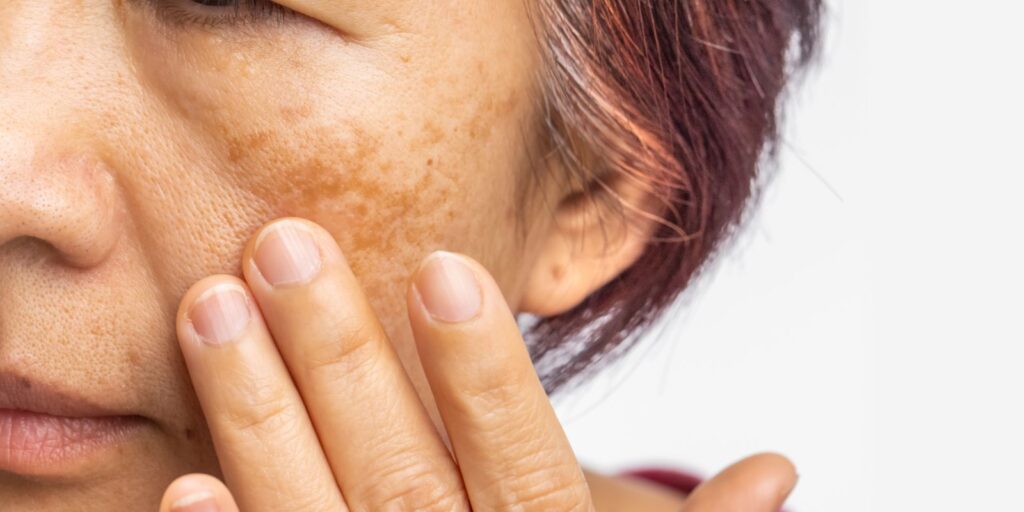 deficiencia de cortisol