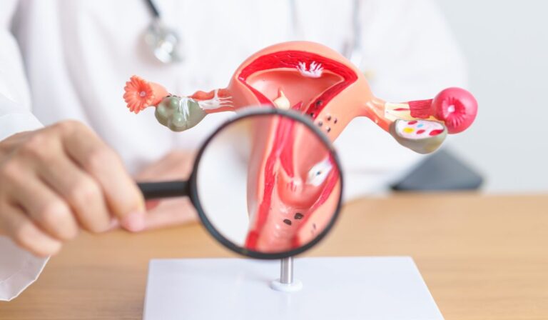 Día Mundial del Cáncer de Ovario conoce la importancia de la detección temprana