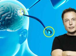 Neuralink-logra-exitosamente-el-primer-implante-de-chip-cerebral-en-un-ser-humano