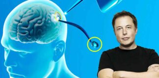 Neuralink-logra-exitosamente-el-primer-implante-de-chip-cerebral-en-un-ser-humano