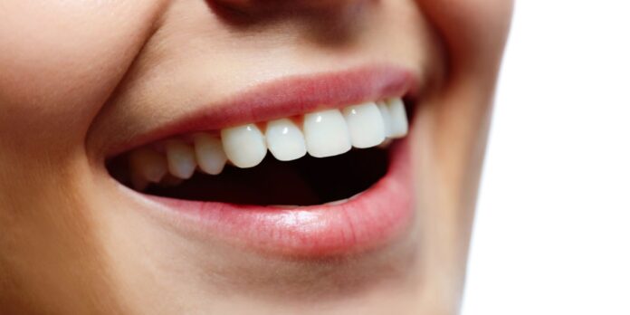 ¿quieres lucir una mejor sonrisa pon en práctica estos 5 consejos